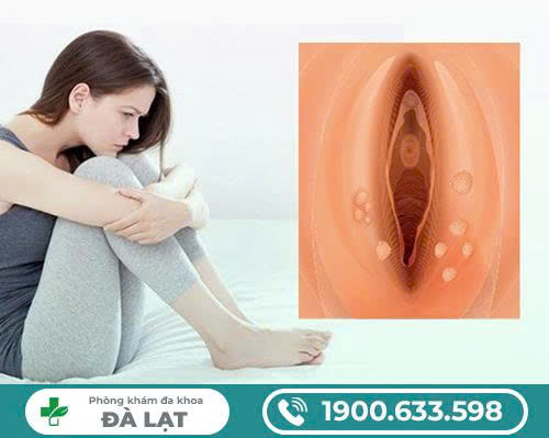 Hình ảnh minh họa